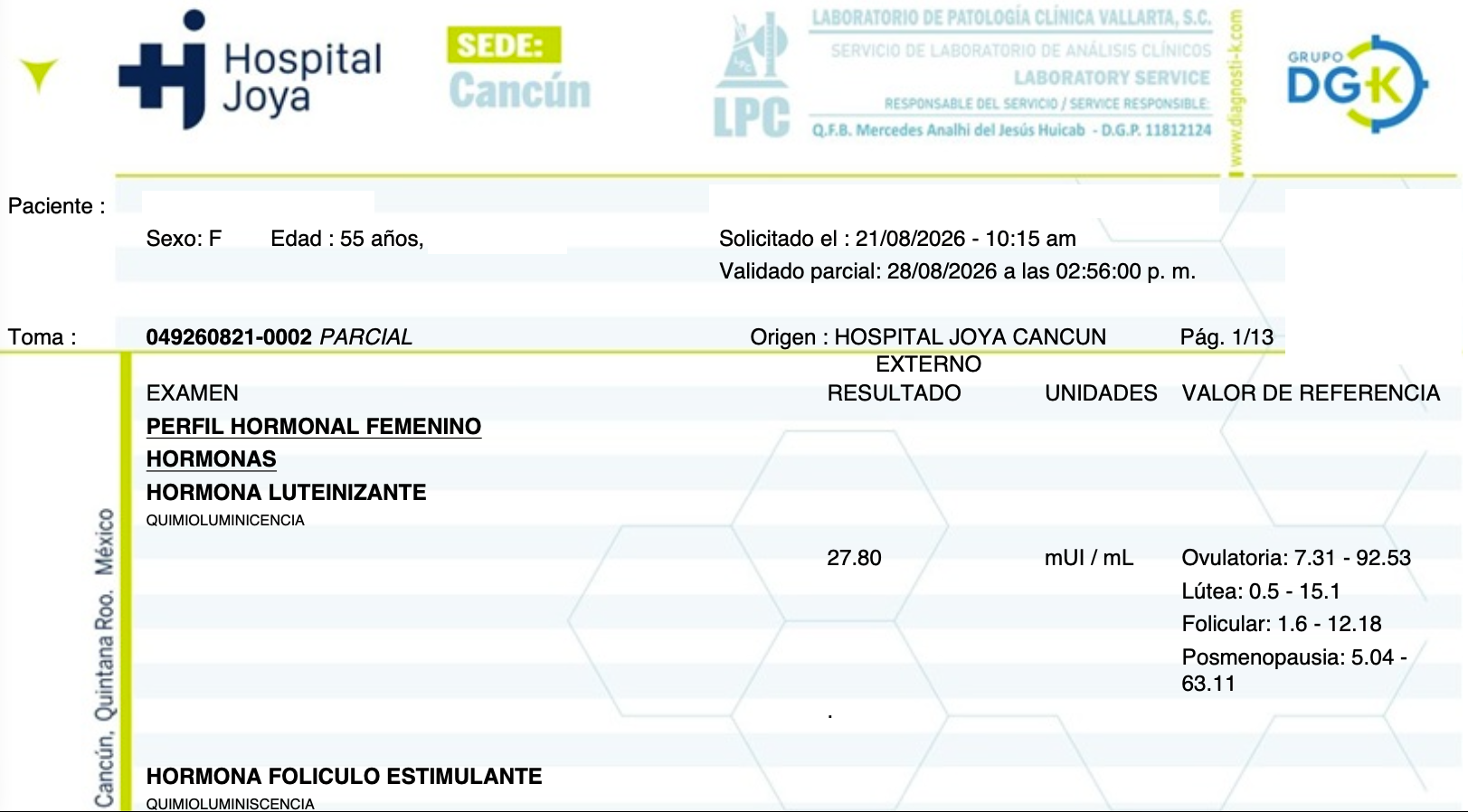 Joya1